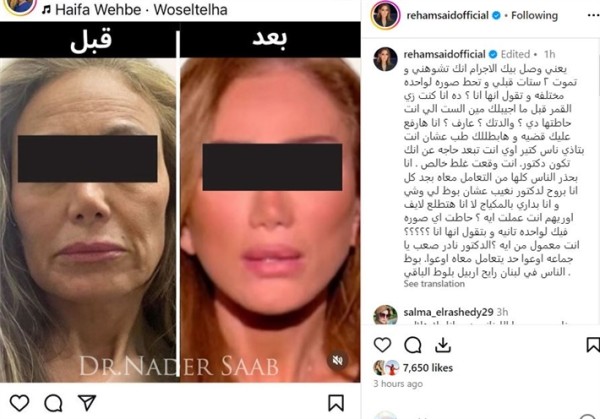 ريهام سعيد قبل و بعد